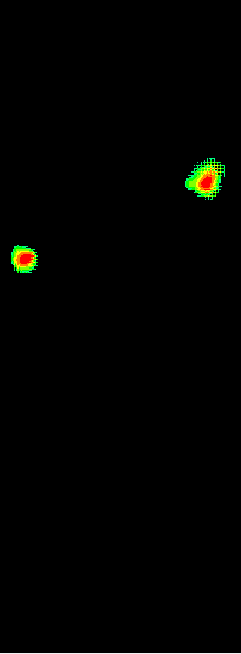 Plantar Pressure Adjust to C